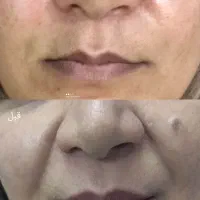 همکاری با لیدر عرب ۵۰ درصد بازاریاب( مشتری یاب)|استخدام درمانی، زیبایی، بهداشتی|مشهد, مصلی (کارمندان اول)|دیوار