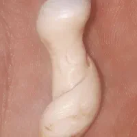 عرج سویحلی باستانی