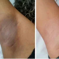 اگر تیرگی های بدنت اعتماد بنفستو گرفته به ما بسپار