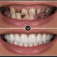 لبخندت رو زیباتر کن /خدمات دندانپزشکی