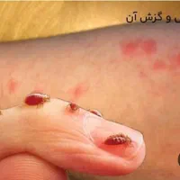 سمپاشی با ضمانت کتبی دریک مرحله سم پاشی ساس ،سوسک|خدمات نظافت|تهران, افسریه شمالی|دیوار