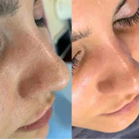 اموزش و خدمات پاکسازی پوست