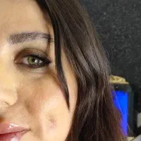 خدمات پیرسینگ زیبایی، چال گونه
