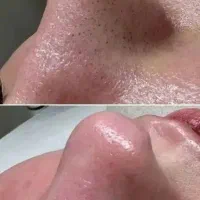 پاکسازی پوست