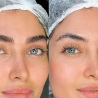 میکروبلیدینگ حرفه ای مخصوص خانم ها و اقایان