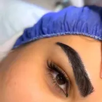 مزو،بوتاکس،چربی،فیلر،جراحی زیبایی صورت وبدن|خدمات آرایشگری و زیبایی|تهران, نارمک|دیوار