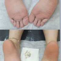 خدمات کفسابی پدیکور|خدمات آرایشگری و زیبایی|خرمآباد, |دیوار