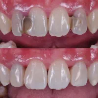 جشنواره یلدایی خدمات دندانپزشکی|خدمات آرایشگری و زیبایی|اردبیل, |دیوار