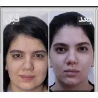 بوکال فت با قیمت خوب. فقط 9900میلیون