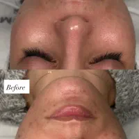 پاکسازی و فشیال‌پوست با برند خارجی انوبیس