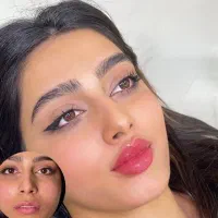 تزریق چربی بدن وصورت