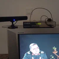 دستگاه دیجیتال ایکس ویژن