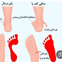 مرکز تخصصی بهبود صافی کف پا و دردهای کف پا|خدمات آرایشگری و زیبایی|بهار, |دیوار