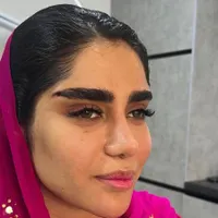 لیفت صورت بینی و غبغب تکنیک اروپایی بدون جراحی|خدمات آرایشگری و زیبایی|مشهد, کوثر|دیوار