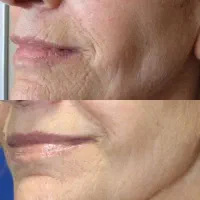 بیومتیک زیبایی اصل
