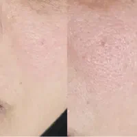 فیشیال تخصصی فقط چهارصد و نود هزار تومان|خدمات آرایشگری و زیبایی|آباده, |دیوار