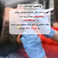 خال برداری/کک و مک/منگوله/ماه گرفتگی/روشن سازی|خدمات آرایشگری و زیبایی|شیراز, کوی زهرا|دیوار