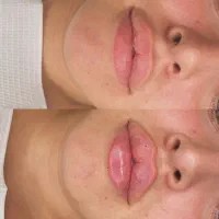 اجاره لاین هاین کلینک هانی انجام تخلیه ناحیه2500|اجارهٔ دفتر کار، اتاق اداری، مطب|خرمآباد, |دیوار