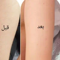 تمام خدمات زیبایی اپیلاسیون اصلاح لیفت و لمینت