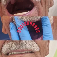 دندانسازی|خدمات آرایشگری و زیبایی|خرم‌آباد, |دیوار