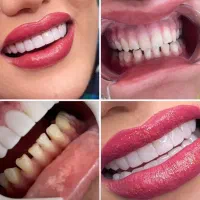 استخدام دندانپزشک پروانه دار تهران