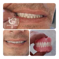 دندان سازی،مصنوعی،دندان متحرک،دندانسازی|خدمات آرایشگری و زیبایی|ارومیه, |دیوار