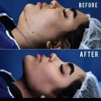 مرکزلیپوساکشن و ساکشن غبغب و زاویه سازی توسط جراح|خدمات آرایشگری و زیبایی|مشهد, سناباد|دیوار