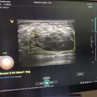 مطب سونوگرافی طرف قرارداد بیمه