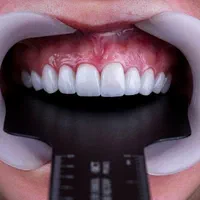 خدمات دندانسازی و دندانپزشکی با تعرفه ویژه|خدمات آرایشگری و زیبایی|شیراز, هفت تنان|دیوار