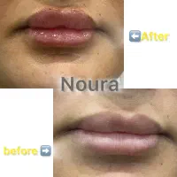 تخفیفات کلینیک زیبایی