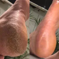 پارافین تراپی پدیکور کفسابی