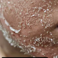 پوست روشن را از ما بخواهید|خدمات آرایشگری و زیبایی|رشت, گلسار|دیوار