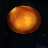 سنگ جزع کلکسونی|کلکسیون اشیاء عتیقه|اهواز, فاز ۱ پادادشهر|دیوار