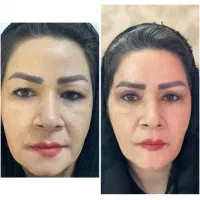 کلینیک دلوین فولادشهر