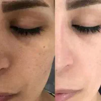 کرم ۸ کاره ضد لک قوی لاکچری کوین