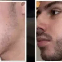 آیا توام دغدغه‌ی پرپشتی ریش داری