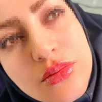 تخفیف 70 درصدی فیلر 890 بوتاکس790 نخ کل صورت 6900|خدمات زیبایی و سلامت|تهران, شهرآرا|دیوار