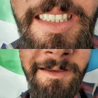 دندانسازی/دندان مصنوعی|خدمات آرایشگری و زیبایی|اندیشه, اندیشه فاز ۱|دیوار