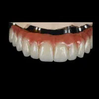 استخدام کارآموز خانم در لابراتوار دندانسازی