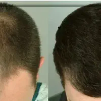 فرصت طلایی برای پوست و مو