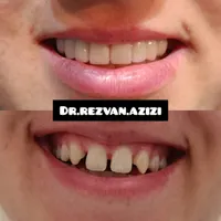 دیگر نگران هزینه‌های سنگین خدمات دندانپزشکی نباشید|خدمات آرایشگری و زیبایی|شیراز, ملاصدرا|دیوار