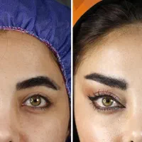 آف۲۰روز/۴۰٪لیفت شقیقه وجراح پلاستیک بدن/دستگاه پال|خدمات آرایشگری و زیبایی|مشهد, کوه سنگی|دیوار