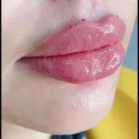 ژل لب|خدمات آرایشگری و زیبایی|اسلامشهر, شهرک مهدیه|دیوار