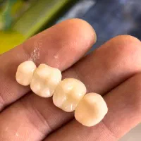 کامپوزیت خرم اباد|خدمات آرایشگری و زیبایی|بروجرد, |دیوار