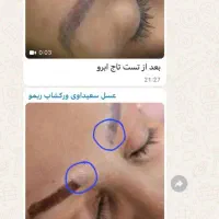 تتوریموو در یک جلسه تضمینی|خدمات آرایشگری و زیبایی|اهواز, کیان اباد|دیوار