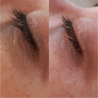 آموزش وپوست و فیشال تخصصی بدون پرداخت مستقیم