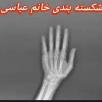 شکسته‌بندی خانــم عباسی نا ف قوموج مفا صل