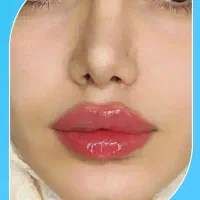 اف ۵۰٪ژل و بوتاکس و مزو...