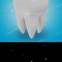 راهنمایی ایمپلنت