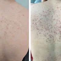 فیشال تخصصی صورت وایتنینگ بدن در کلینیک زیرنظرپزشک|خدمات آرایشگری و زیبایی|اسلامشهر, باغ فیض|دیوار